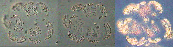 Phaeocystis cf. pouchetii