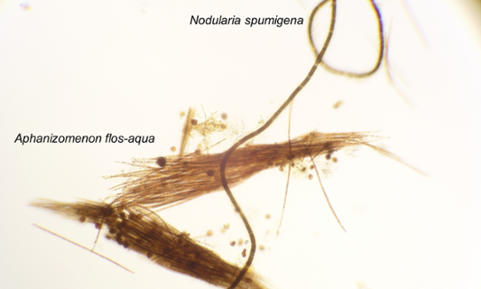 Aphanizomenon och Nodularia under mikroskopet.