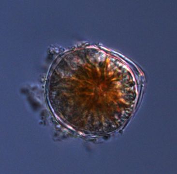 Dinoflagellater ur släktet Alexandrium